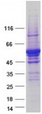 SDS-PAGE TPH2-2024H.jpg